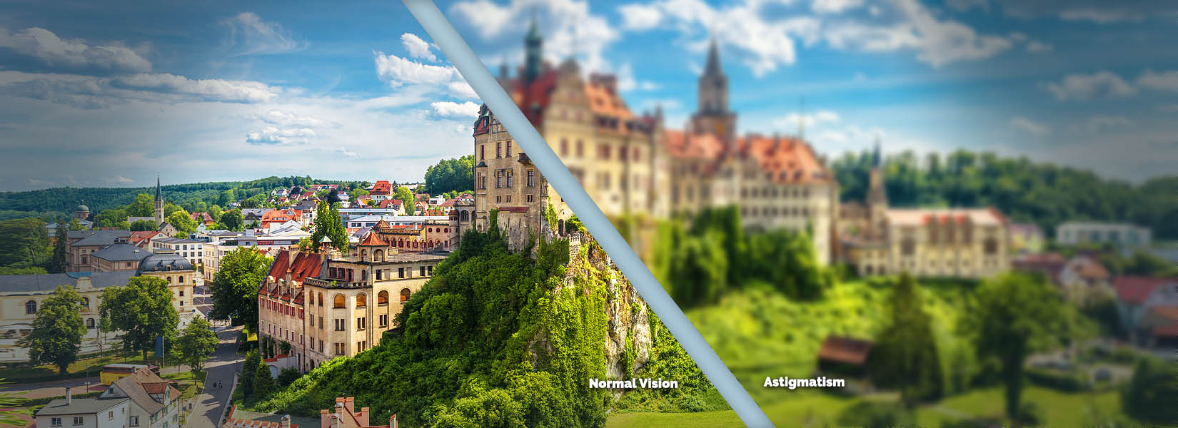 Astigmatism Treatment in Alton