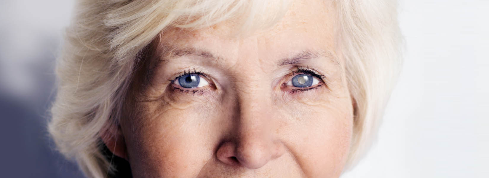 Cataract Surgery in Alton